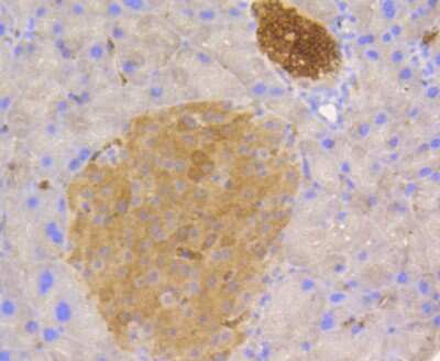 Immunohistochemistry-Paraffin: STAT3 Antibody (SY24-08) [NBP2-67432]