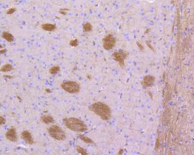 Immunohistochemistry-Paraffin: STAT3 Antibody (SY24-08) [NBP2-67432]