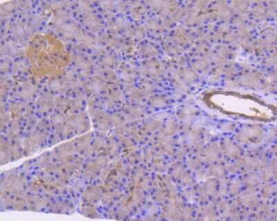 Immunohistochemistry-Paraffin: STAT3 Antibody (SY24-08) [NBP2-67432]