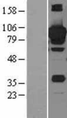 Western Blot: STAT3 Overexpression Lysate [NBL1-16525]