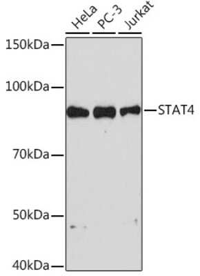 Western Blot: STAT4 Antibody (10H10O9) [NBP3-16425]