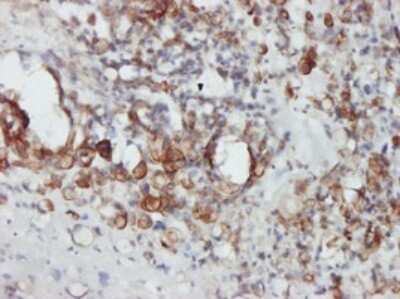Immunohistochemistry-Paraffin: STAT4 Antibody (1C2-1C12) [H00006775-M01]