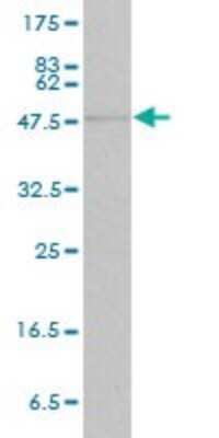 Western Blot: STAT4 Antibody (1C2-1C12) [H00006775-M01]