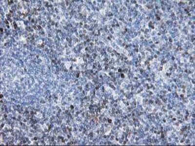 Immunohistochemistry-Paraffin: STAT4 Antibody (OTI2F3) [NBP2-00851]