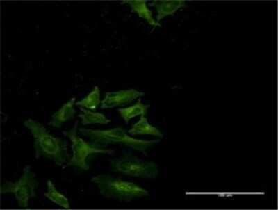 Immunocytochemistry/ Immunofluorescence: STAT4 Antibody (2H4-1G8) [H00006775-M02]