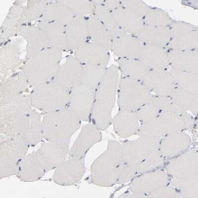 Immunohistochemistry-Paraffin: STAT4 Antibody [NBP1-89474]