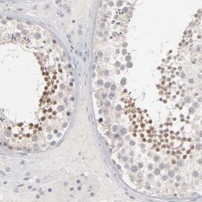 Immunohistochemistry-Paraffin: STAT4 Antibody [NBP1-89474]