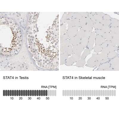 Immunohistochemistry-Paraffin: STAT4 Antibody [NBP1-89474]