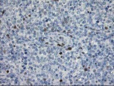 Immunohistochemistry: STAT4 Antibody (OTI2F3) - Azide and BSA Free [NBP2-74389]