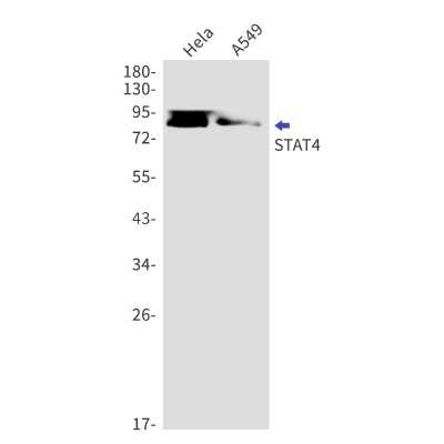 Western Blot: STAT4 Antibody (S02-1C1) [NBP3-14977]