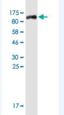 Western Blot: STAT4 Antibody (S1) [H00006775-M02A-200ul]