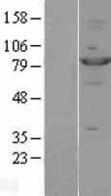 Western Blot: STAT4 Overexpression Lysate [NBL1-16527]