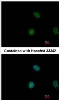 Immunocytochemistry/ Immunofluorescence: STAT5A Antibody [NBP2-20505]