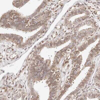 Immunohistochemistry-Paraffin: STAT5A Antibody [NBP1-81051]