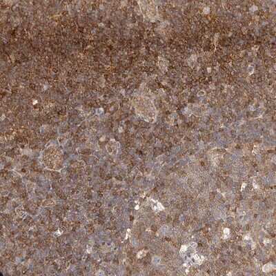 Immunohistochemistry-Paraffin: STAT5A Antibody [NBP1-81051]