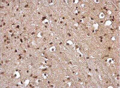 Immunohistochemistry-Paraffin: STAT5A Antibody [NBP2-20505]
