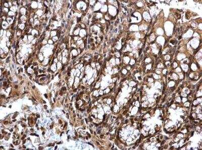 Immunohistochemistry-Paraffin: STAT5A Antibody [NBP2-20505]