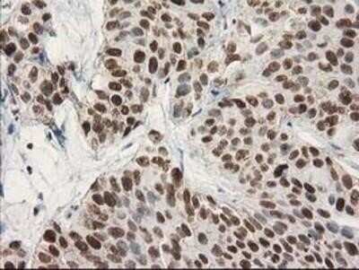 Immunohistochemistry: STAT5A Antibody (OTI9F7) - Azide and BSA Free [NBP2-74392]