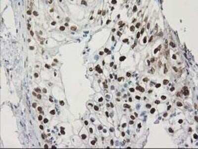 Immunohistochemistry: STAT5A Antibody (OTI9F7) - Azide and BSA Free [NBP2-74392]