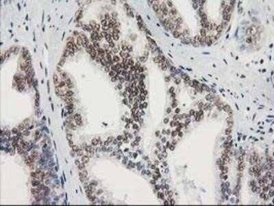 Immunohistochemistry: STAT5A Antibody (OTI9F7) - Azide and BSA Free [NBP2-74392]