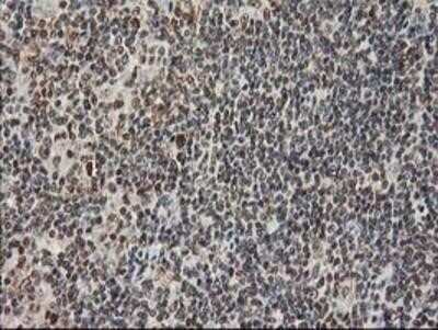 Immunohistochemistry: STAT5A Antibody (OTI9F7) - Azide and BSA Free [NBP2-74392]