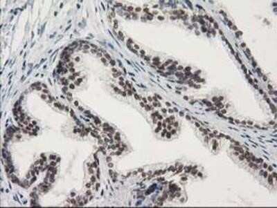 Immunohistochemistry: STAT5A Antibody (OTI9F7) - Azide and BSA Free [NBP2-74392]