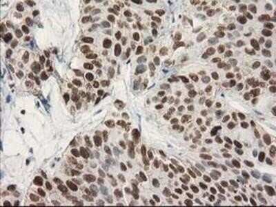 Immunohistochemistry-Paraffin: STAT5A Antibody (OTI9F7) [NBP2-00622]