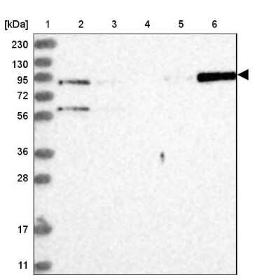 Western Blot: STAT5A Antibody [NBP1-81051]