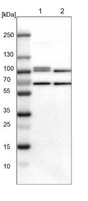 Western Blot: STAT5A Antibody [NBP1-81051]