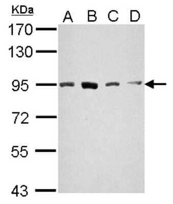 Western Blot: STAT5A Antibody [NBP2-20505]