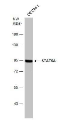 Western Blot: STAT5A Antibody [NBP2-20505]