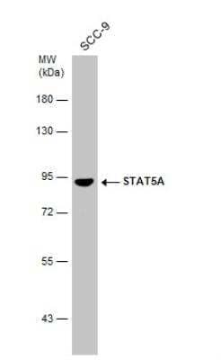 Western Blot: STAT5A Antibody [NBP2-20505]