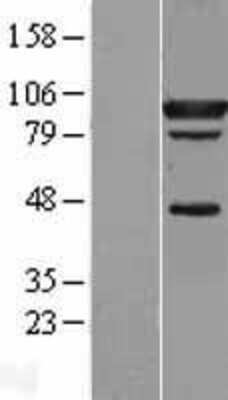 Western Blot: STAT5A Overexpression Lysate [NBL1-16528]