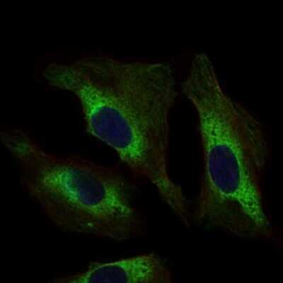 Immunocytochemistry/ Immunofluorescence: STAT5A Antibody (6D4) - BSA Free [NBP2-37441]