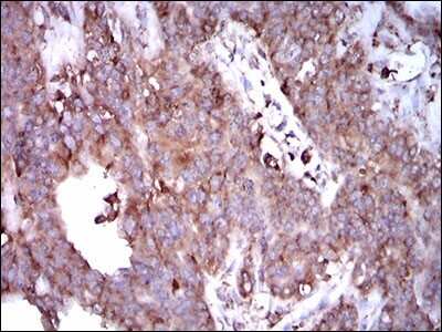 Immunohistochemistry: STAT5A Antibody (6D4) - BSA Free [NBP2-37441]