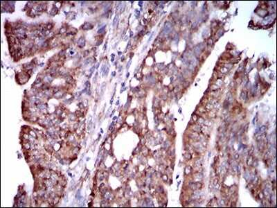 Immunohistochemistry: STAT5A Antibody (6D4) - BSA Free [NBP2-37441]