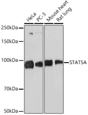 Western Blot: STAT5a/b Antibody (3J2A2) [NBP3-16533]