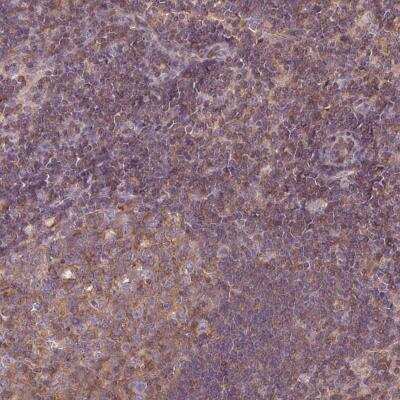 Immunohistochemistry: STAT5a/b Antibody [NBP2-46786]