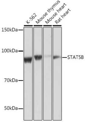 Western Blot: STAT5b Antibody (6P5T0) [NBP3-15778]