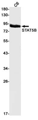 Western Blot: STAT5b Antibody (S01-6A3) [NBP3-20057]