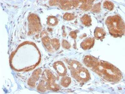 Immunohistochemistry-Paraffin: STAT5b Antibody (STAT5B/2611) - Azide and BSA Free [NBP2-79907]