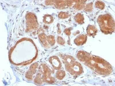 Immunohistochemistry-Paraffin: STAT5b Antibody (STAT5B/2611) [NBP2-79773]