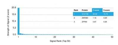 Protein Array: STAT5b Antibody (STAT5B/2611) [NBP2-79773]