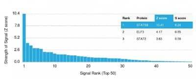 Protein Array: STAT5b Antibody (STAT5B/2657) [NBP3-07323]