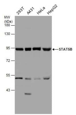 Western Blot: STAT5b Antibody [NBP3-13069]