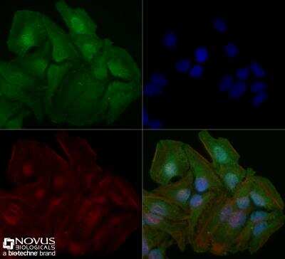Immunocytochemistry/ Immunofluorescence: STAT6 Antibody (177C322.1) - BSA Free [NBP2-25241]