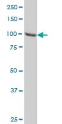 Western Blot: STAT6 Antibody (6C10) [H00006778-M01]