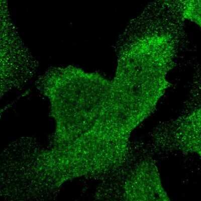 STAT6 Antibody - BSA Free (NBP1-85345) by Novus, Part of Bio