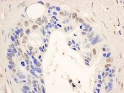 Immunohistochemistry-Paraffin: STAT6 Antibody [NB600-229]