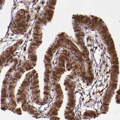 STAT6 Antibody - BSA Free (NBP1-85345) by Novus, Part of Bio